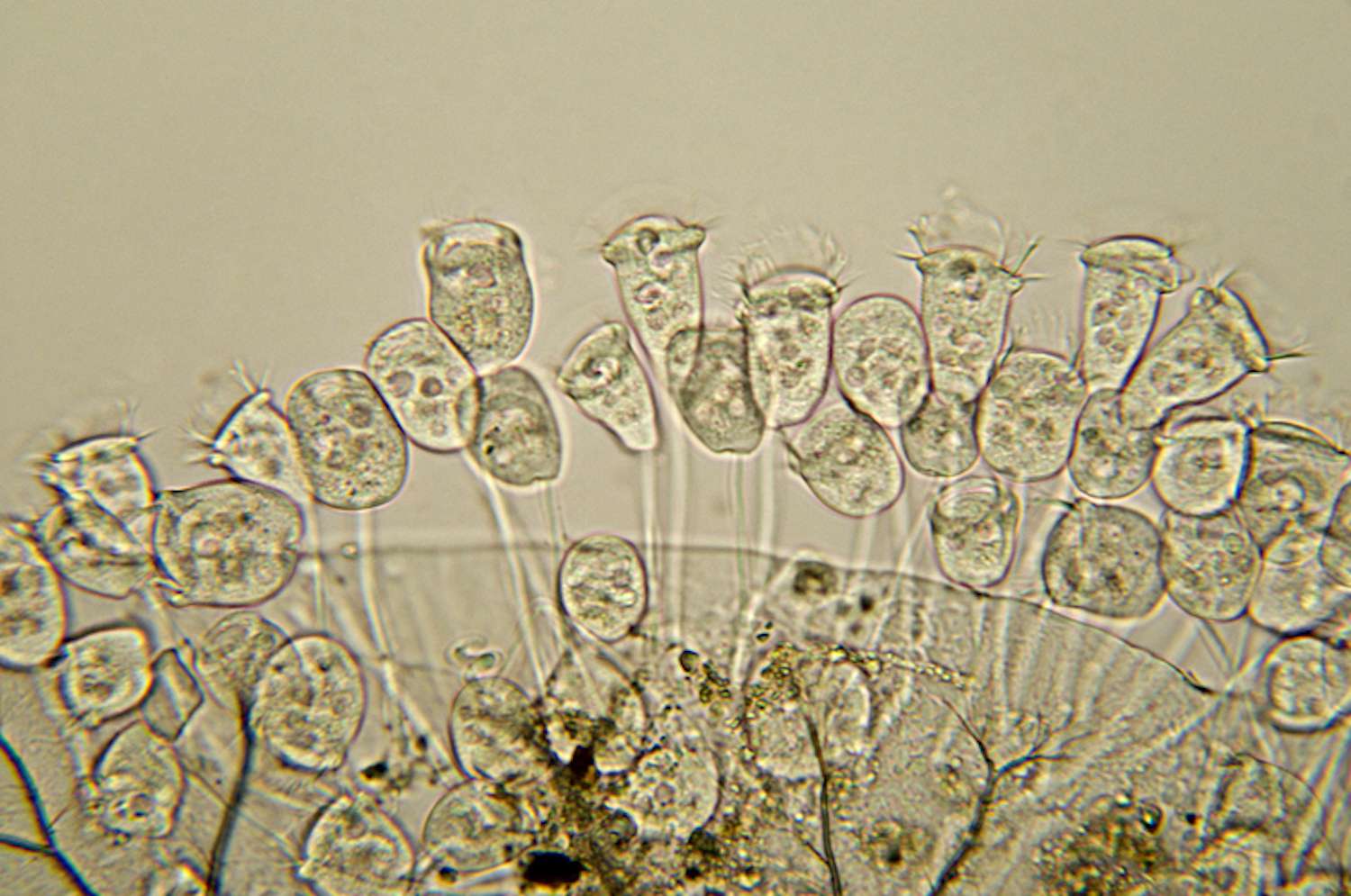 Микрофотография видов vorticella.